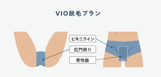レジーナクリニックオムのVIO脱毛プランの参考画像