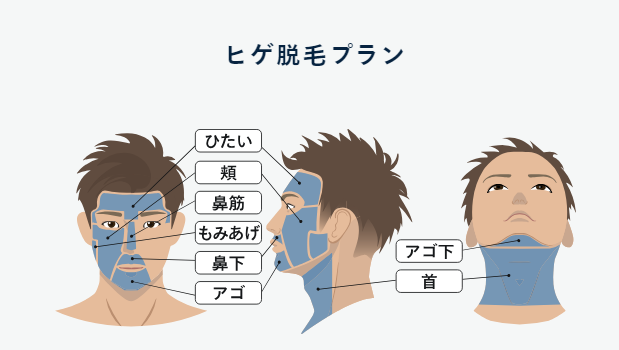 レジーナクリニックオムのヒゲ脱毛プランの参考画像