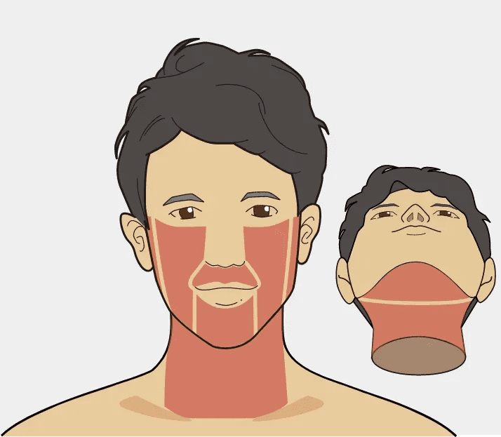 ゴリラクリニックのヒゲ脱毛の画像